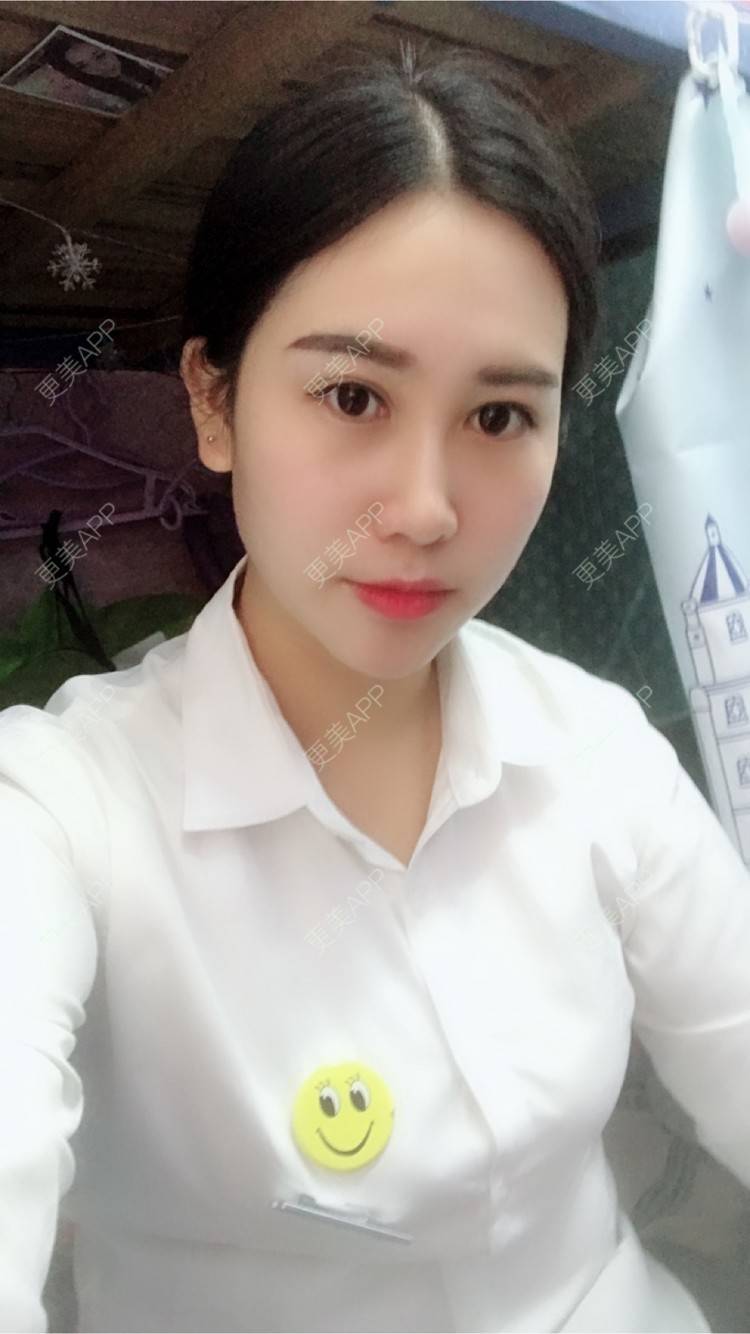 更美 - 更美用户50063163的玻尿酸经验 | 上海 | 假体隆胸 | 隆鼻 | 广州 | 埋线提升 | 北京 | 玻尿酸