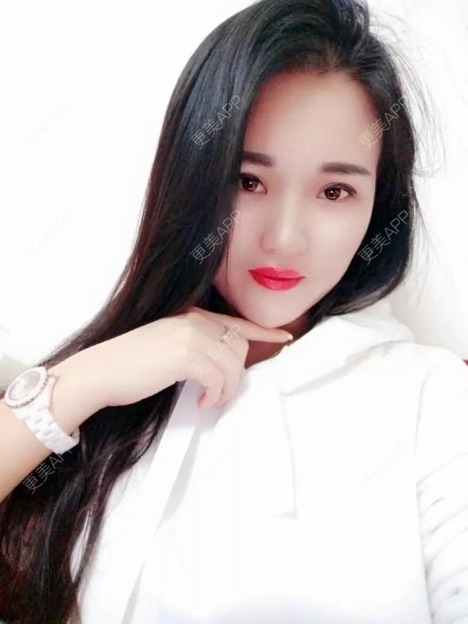 更美 - 再以永恒为基的自体脂肪隆鼻经验 | 西安 | 自体脂肪隆鼻