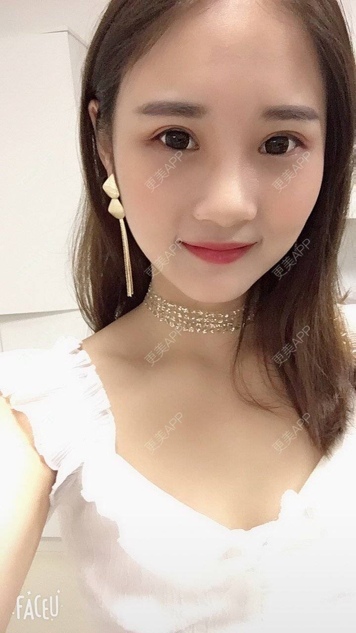 更美 - 安安ANan。的胶原蛋白淡化黑眼圈经验 | 胶原蛋白淡化黑眼圈 | 重庆