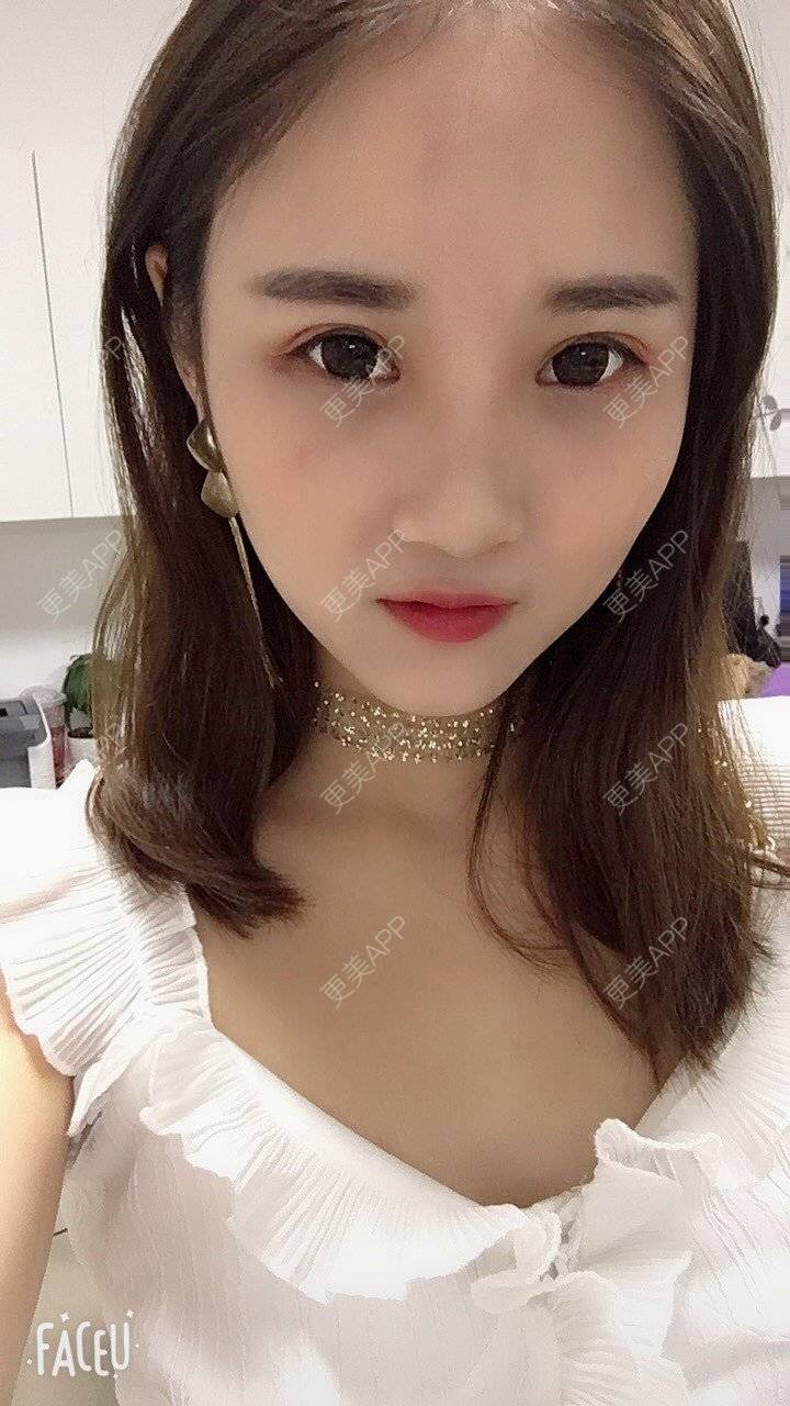 更美 - 安安ANan。的胶原蛋白淡化黑眼圈经验 | 胶原蛋白淡化黑眼圈 | 重庆