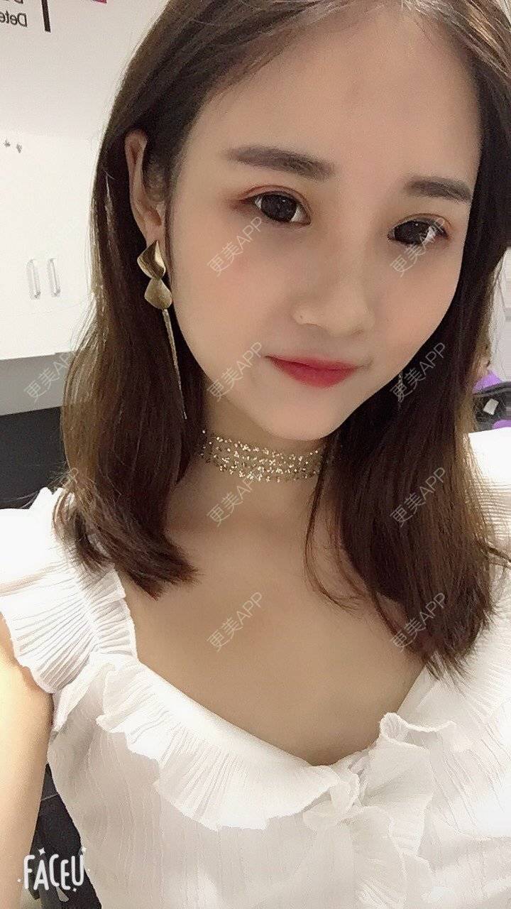 更美 - 安安ANan。的胶原蛋白淡化黑眼圈经验 | 胶原蛋白淡化黑眼圈 | 重庆