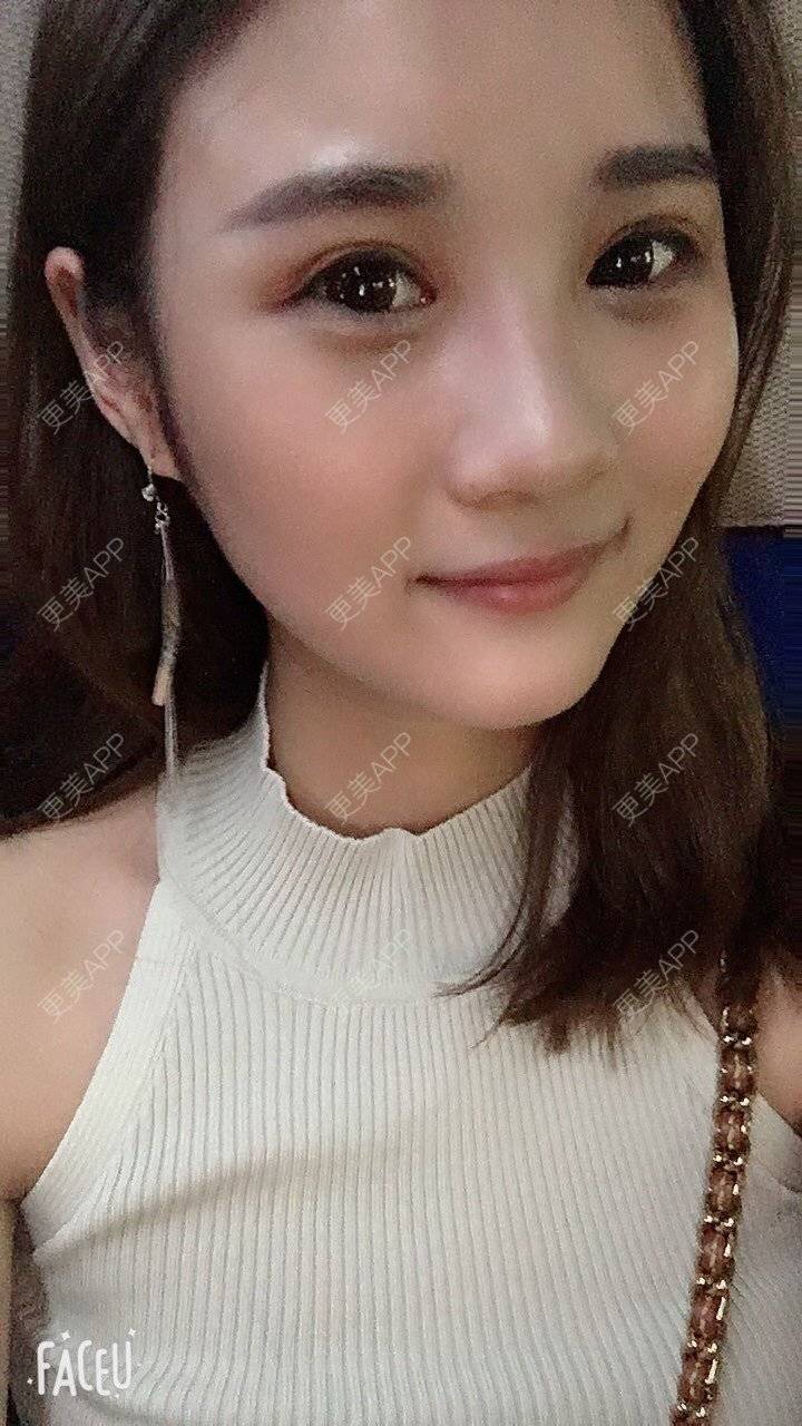 更美 - 安安ANan。的胶原蛋白淡化黑眼圈经验 | 胶原蛋白淡化黑眼圈 | 重庆