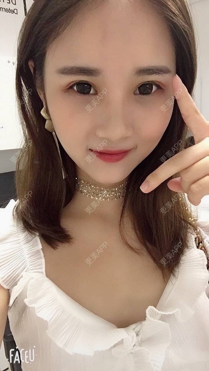 更美 - 安安ANan。的胶原蛋白淡化黑眼圈经验 | 胶原蛋白淡化黑眼圈 | 重庆
