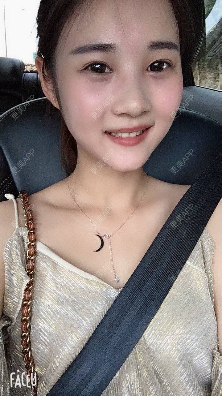 更美 - 安安ANan。的胶原蛋白淡化黑眼圈经验 | 胶原蛋白淡化黑眼圈 | 重庆