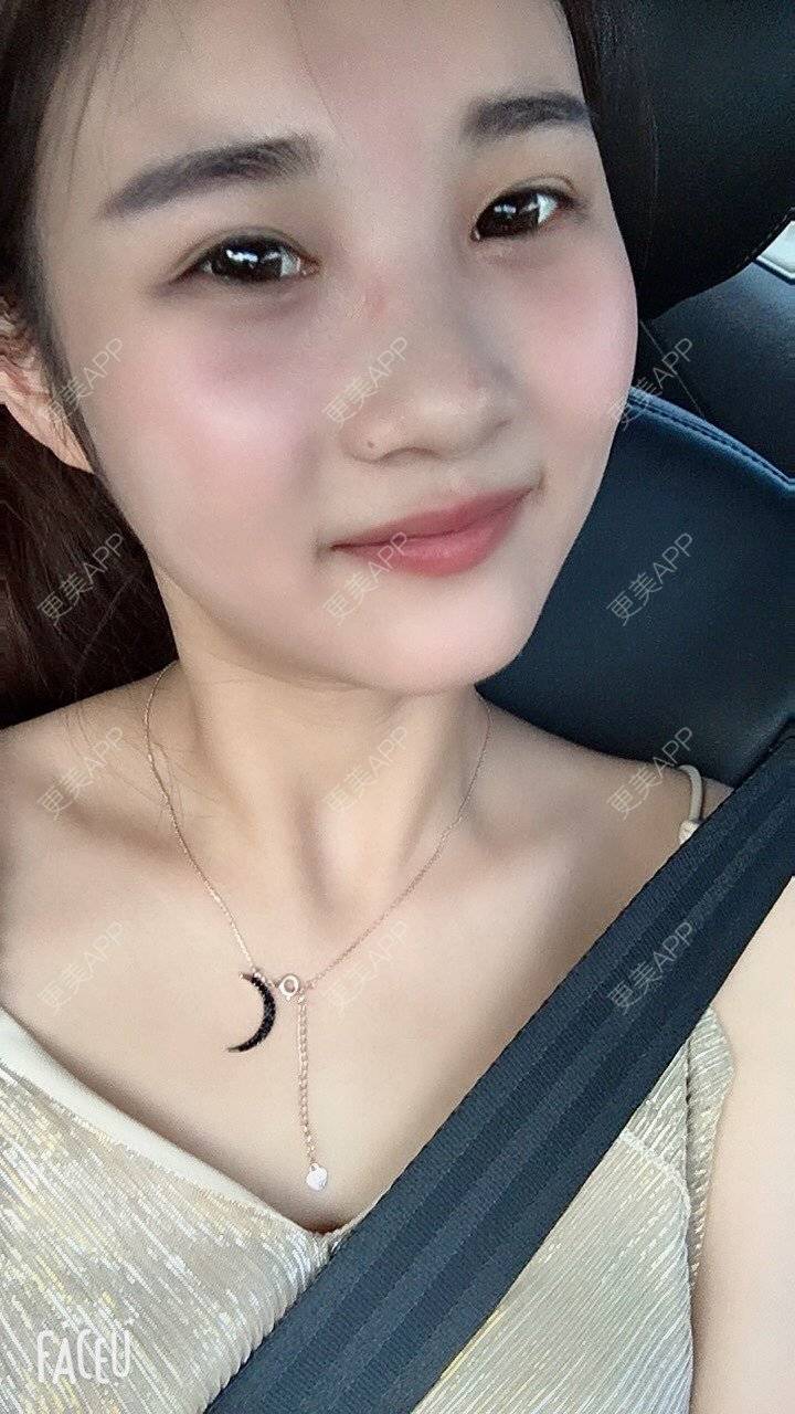 更美 - 安安ANan。的胶原蛋白淡化黑眼圈经验 | 胶原蛋白淡化黑眼圈 | 重庆