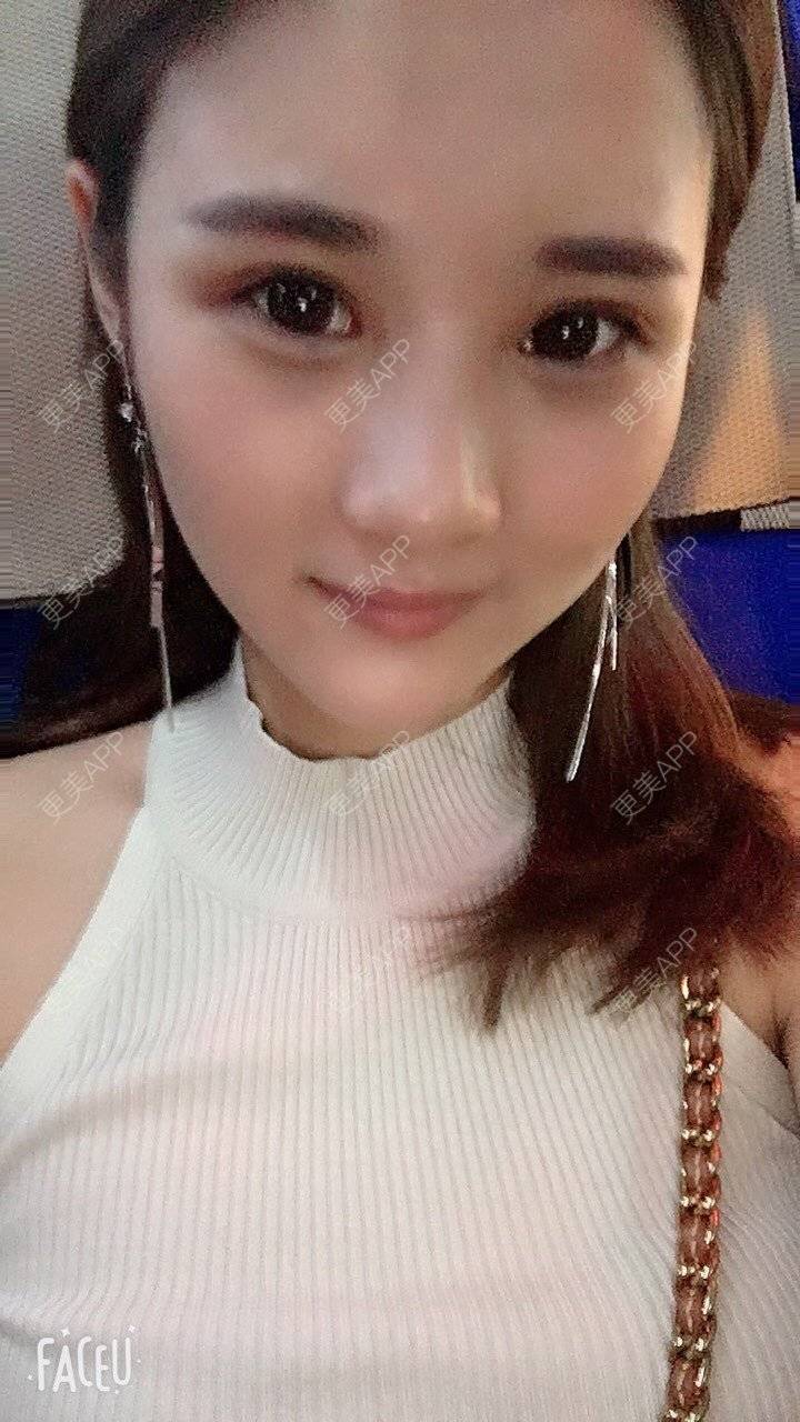 更美 - 安安ANan。的胶原蛋白淡化黑眼圈经验 | 胶原蛋白淡化黑眼圈 | 重庆