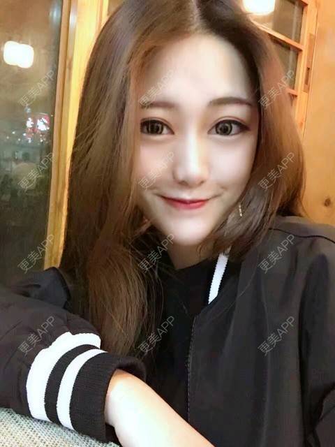 m无处安放的女人的玻尿酸下巴日记