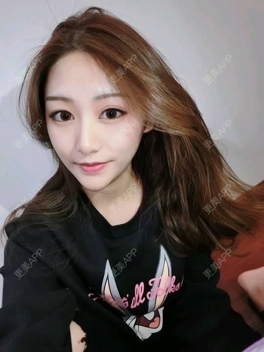 m无处安放的女人的玻尿酸下巴日记