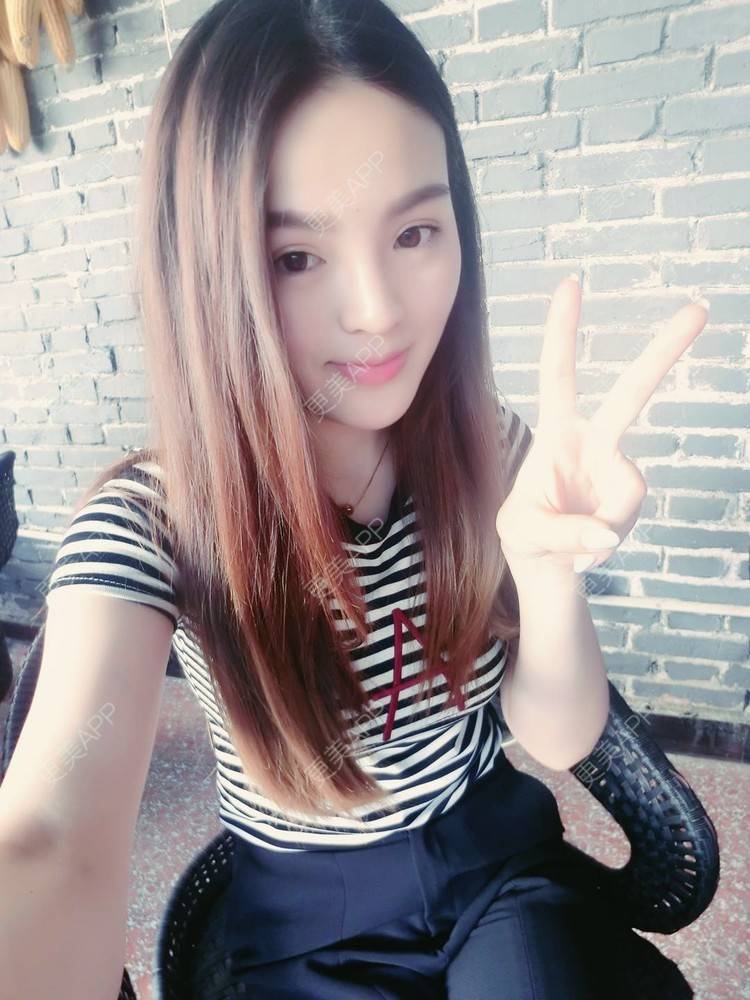 更美 - 更美用户wSuQNG6YOw的鼻中隔软骨隆鼻经验 | 西安 | 鼻中隔软骨隆鼻