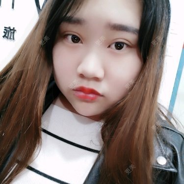 耳软骨隆鼻