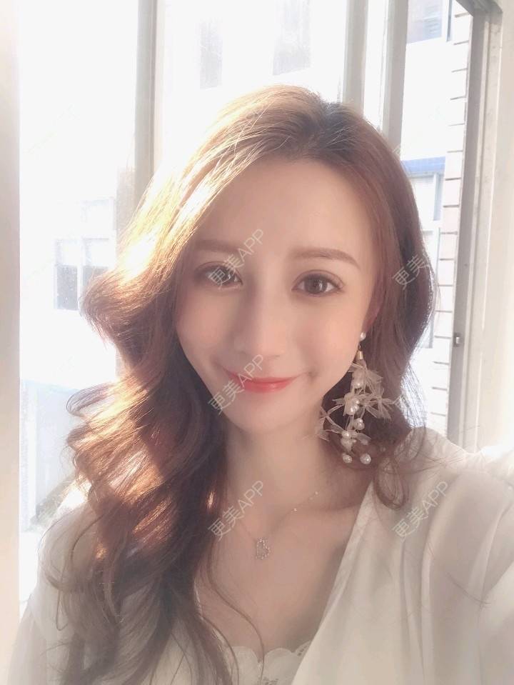 更美 - 潘神的魔盒的驼峰鼻矫正经验 | 视频日记 | 驼峰鼻矫正 | 广州