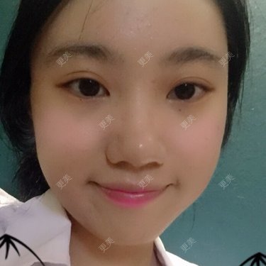 鼻部整形