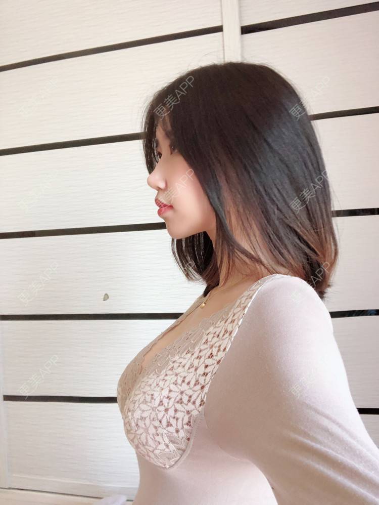 梅梅1314的丰胸隆胸日记