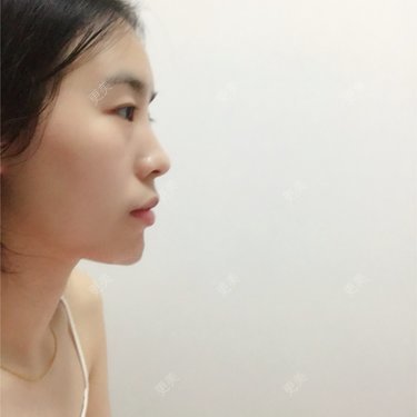 硅胶垫下巴