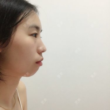 硅胶垫下巴