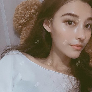 眼部综合