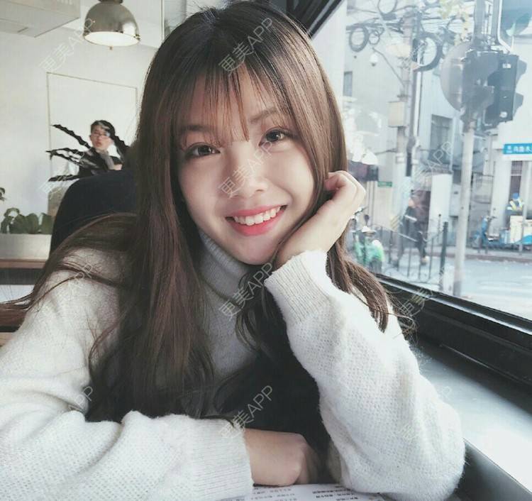 更美 - 留佳斯的冷光美白经验 | 成都 | 冷光美白