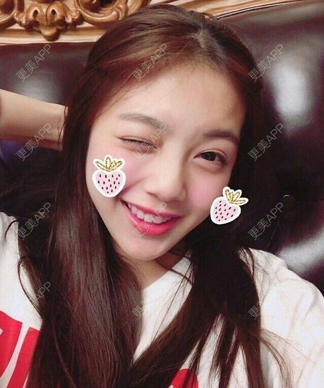 更美 - 留佳斯的冷光美白经验 | 成都 | 冷光美白