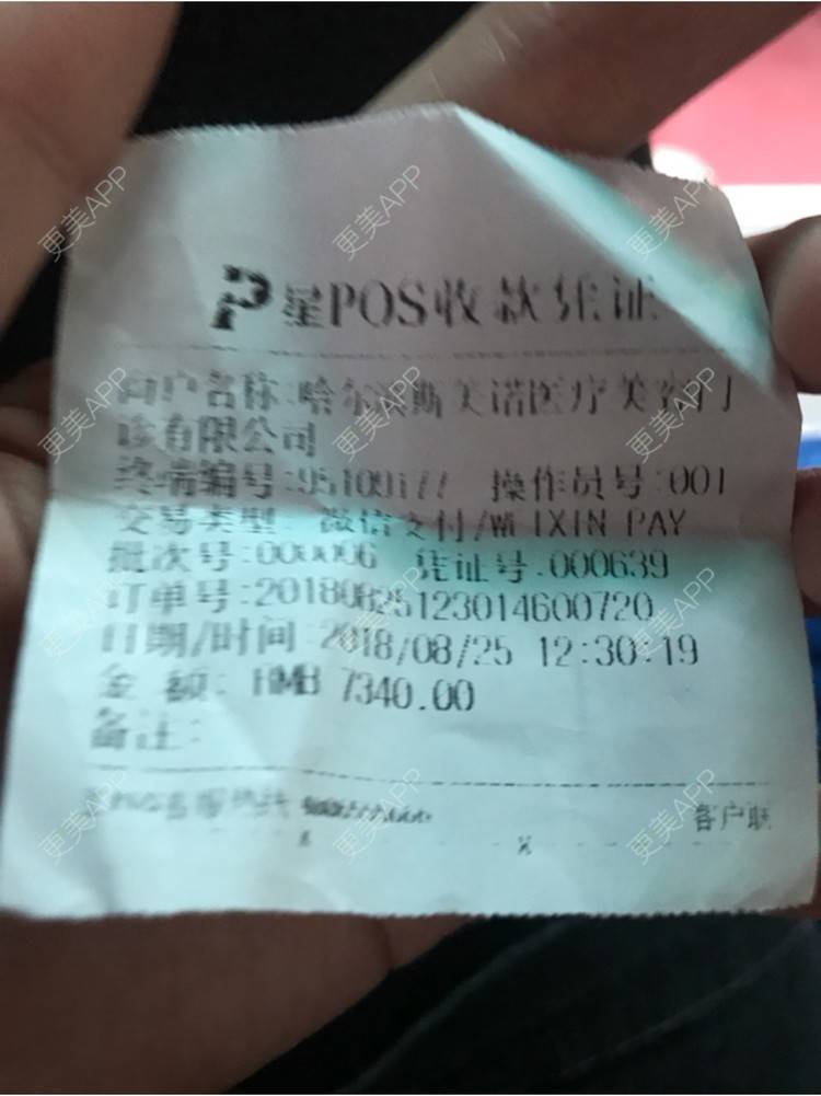 更美 - 更美用户SGWuwusOg1的埋线提升经验 | 祛斑祛色素 | 埋线提升 | 红蓝光清痘 | 自体脂肪隆胸 | 鼻部多项 | 玻尿酸 | 哈尔滨