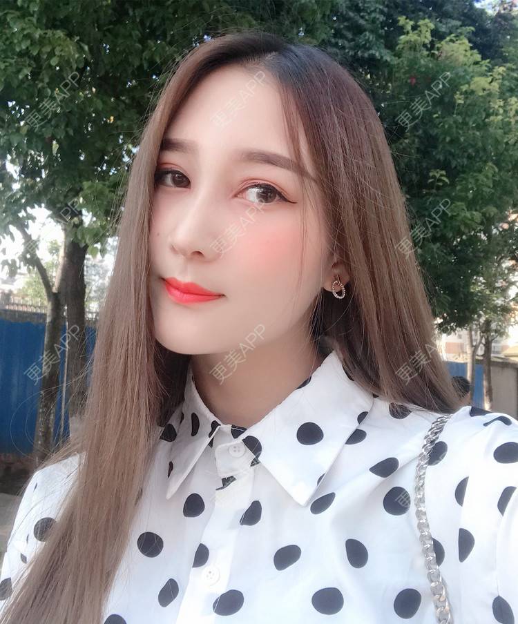 天使爱美腻滴的隆鼻日记