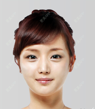 更美 - 王洪勇 医生的自体脂肪全面部填充经验 | 自体脂肪全面部填充 | 广州