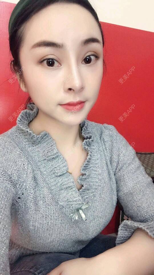 更美 - 80後粉翼天的切眉经验 | 北京 | 切眉