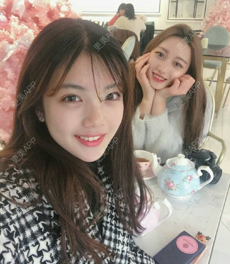 更美 - 留佳斯的冷光美白经验 | 成都 | 冷光美白