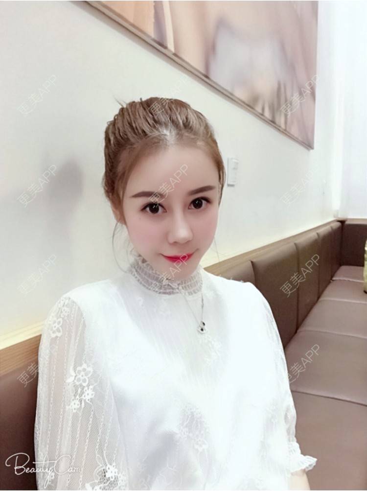 更美 - 🍓盆盆的半永久纹眉经验 | 冷光美白 | 阴唇整形 | 北京 | 广州 | 深圳 | 半永久纹眉