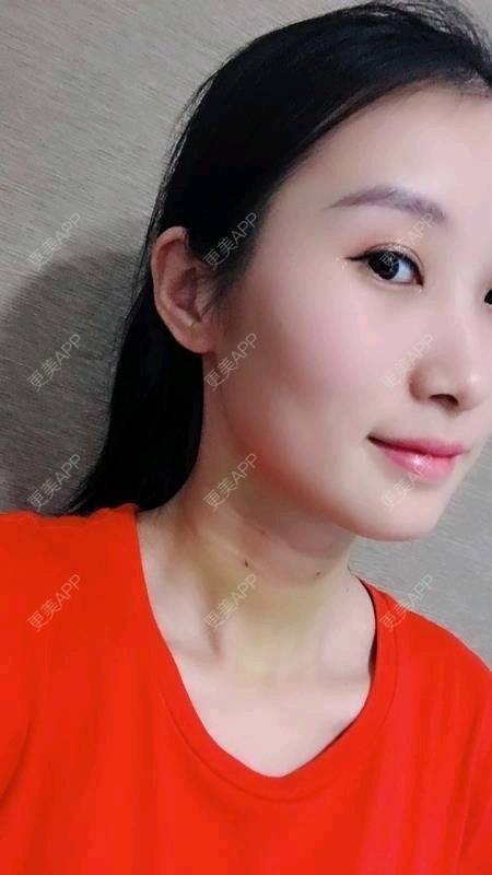 更美 - Annie嵉的自体脂肪填充颈纹经验 | 上海 | 自体脂肪填充颈纹