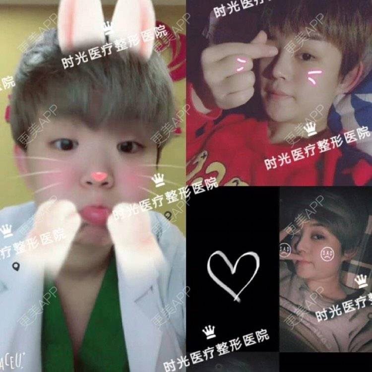 更美 - 南昌时光医疗美容门诊部的隆鼻经验 | 南昌 | 视频日记 | 隆鼻