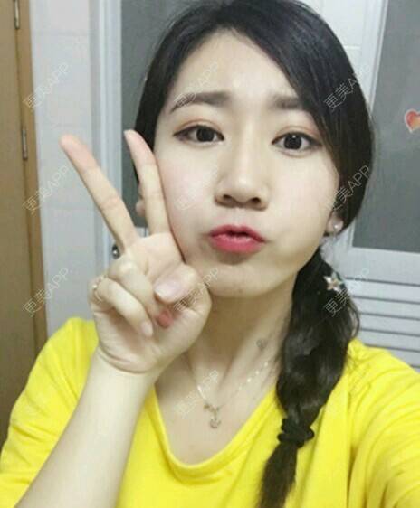 更美 - 玉兔的主人的冷光美白经验 | 成都 | 冷光美白