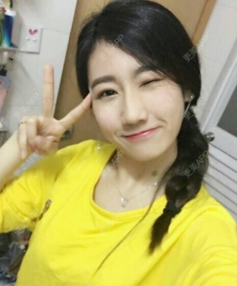 更美 - 玉兔的主人的冷光美白经验 | 成都 | 冷光美白