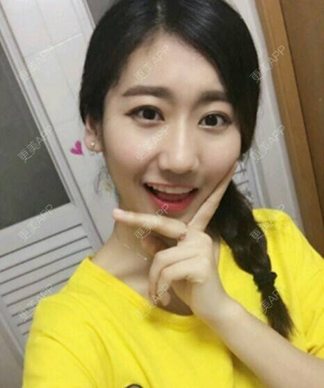 更美 - 玉兔的主人的冷光美白经验 | 成都 | 冷光美白