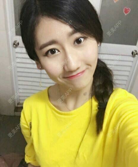 更美 - 玉兔的主人的冷光美白经验 | 成都 | 冷光美白