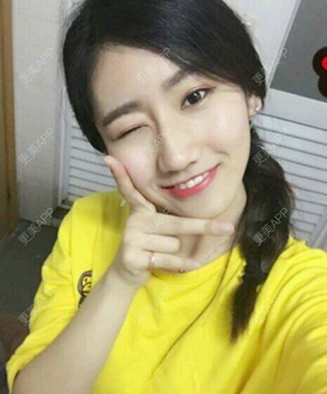 更美 - 玉兔的主人的冷光美白经验 | 成都 | 冷光美白