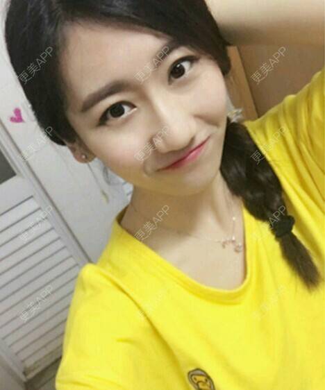 更美 - 玉兔的主人的冷光美白经验 | 成都 | 冷光美白