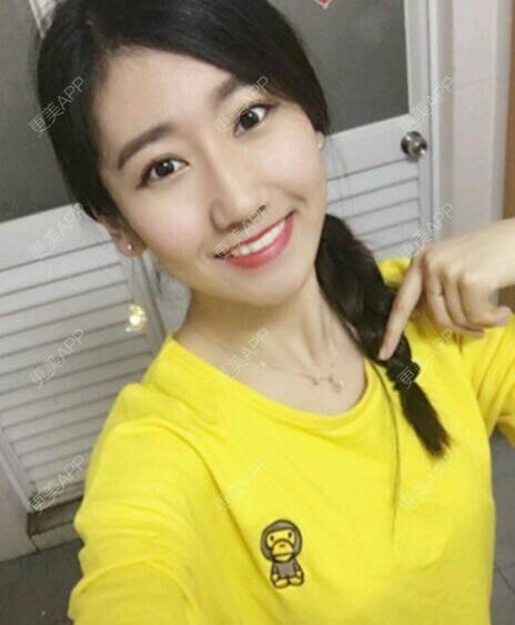 更美 - 玉兔的主人的冷光美白经验 | 成都 | 冷光美白