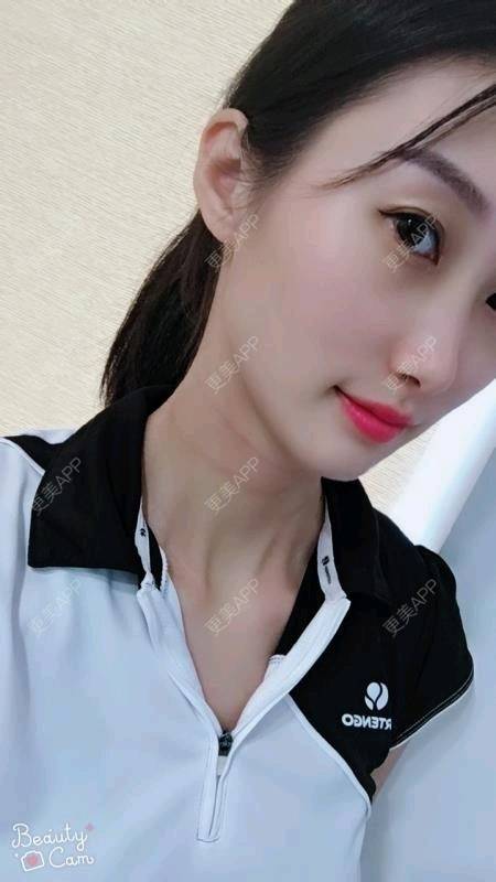 更美 - Annie嵉的自体脂肪填充颈纹经验 | 上海 | 自体脂肪填充颈纹