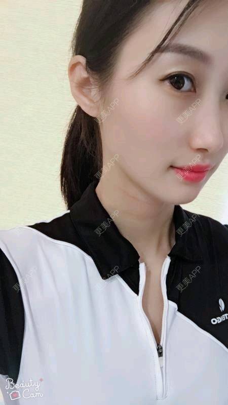 更美 - Annie嵉的自体脂肪填充颈纹经验 | 上海 | 自体脂肪填充颈纹