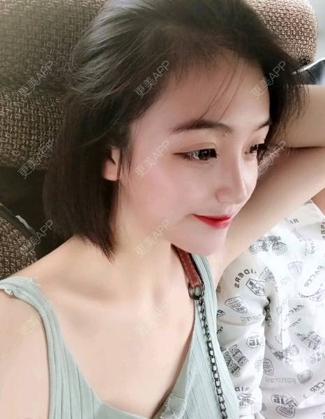 更美 - 更美用户Vgp7t3iO67的鼻部多项经验 | 除皱瘦脸 | 鼻部多项 | 微针水光 | 玻尿酸 | 成都