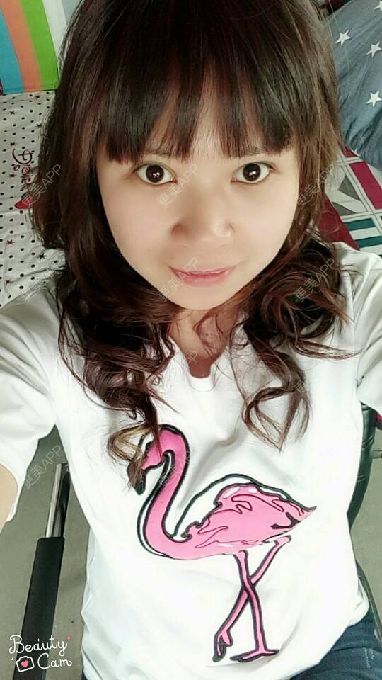 更美 - 不语却知心。的人中缩短经验 | 人中缩短 | 杭州 | 水光项目 | 双眼皮 | 白瓷娃娃 | 蚌埠 | 广州 | 深圳 | 牙贴面 | 南京 | 全切双眼皮