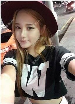 更美 - 苍卉的自体脂肪隆鼻经验 | 自体脂肪隆鼻 | 西安