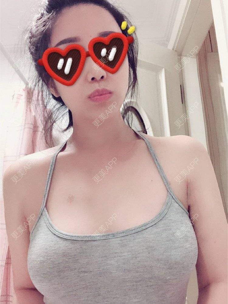 施锦的丰胸隆胸日记