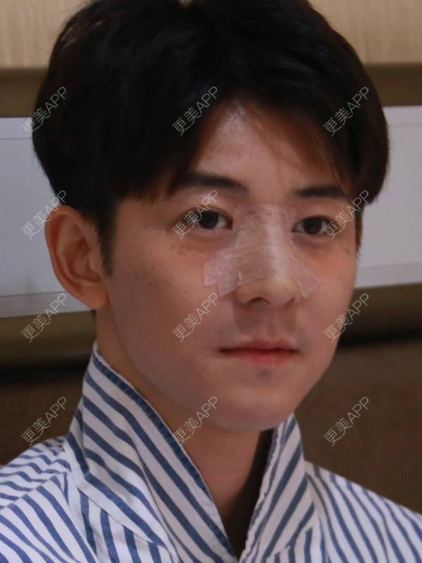 更美 - 唐航 医生的隆鼻经验 | 隆鼻 | 深圳