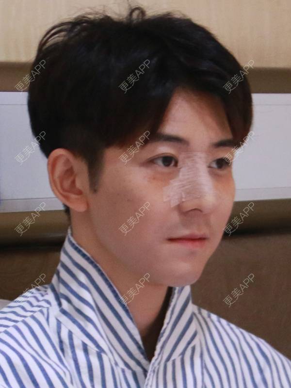 更美 - 唐航 医生的隆鼻经验 | 隆鼻 | 深圳