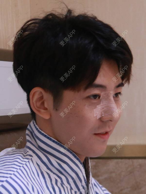 更美 - 唐航 医生的隆鼻经验 | 隆鼻 | 深圳