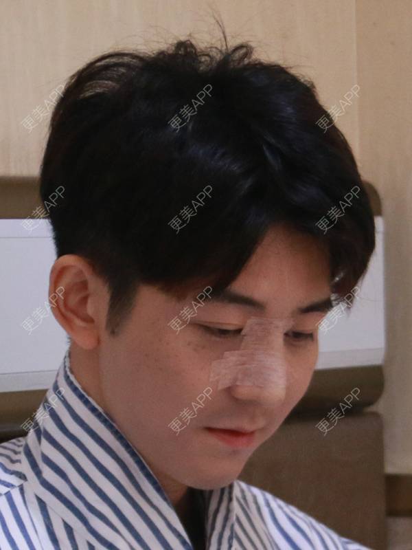 更美 - 唐航 医生的隆鼻经验 | 隆鼻 | 深圳