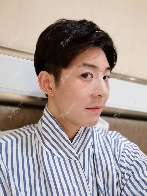 更美 - 唐航 医生的隆鼻经验 | 隆鼻 | 深圳