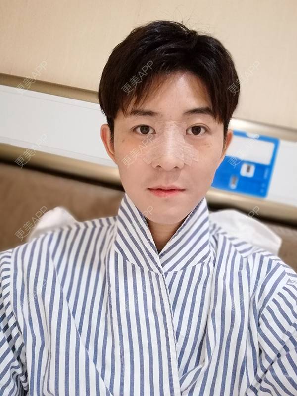 更美 - 唐航 医生的隆鼻经验 | 隆鼻 | 深圳