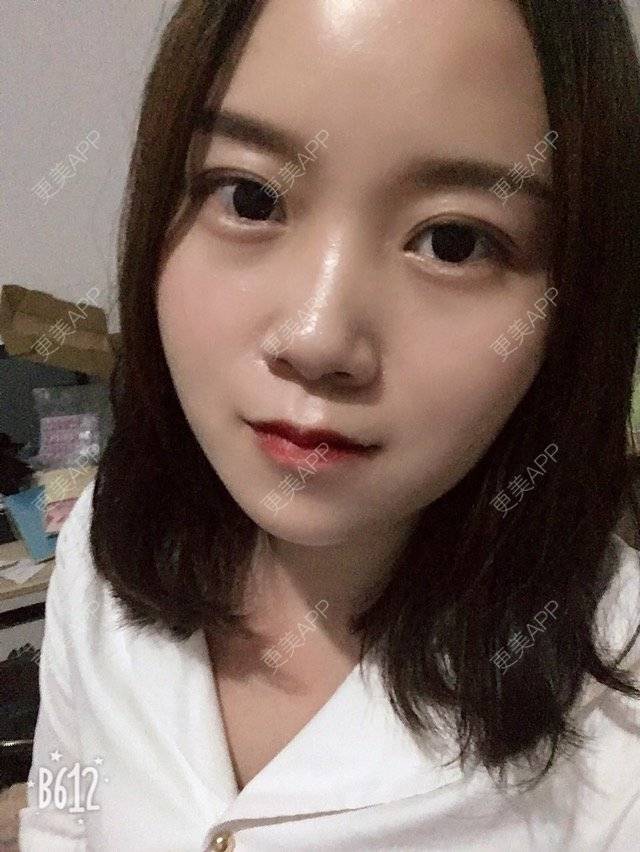更美 - 圆方脸课代表ʚ😊ɞ的半永久妆经验 | 半永久妆 | 武汉